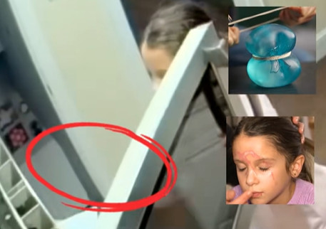 Devojčica ispekla lice zbog opasnog trenda: Vatrogasci izdali hitno upozorenje roditeljima