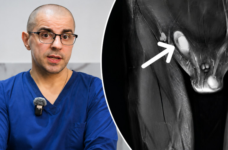 Nespušteni testis kod dece: Doktor Milivojević za Mame.rs otkriva kada je pravo vreme za pregled i lečenje?