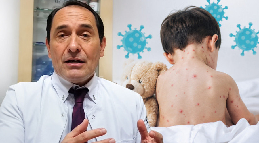Da li dete sa ovčjim boginjama sme da se kupa? Srpski pedijatar rešio dilemu za svagda