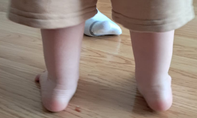 Mama pokazala kako njen sin od 17 meseci hoda: Roditelji odmah primetili isti problem