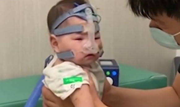 Bila je manja od grejpfruta kada se rodila: Ova devojčica bila je teška samo 212 grama