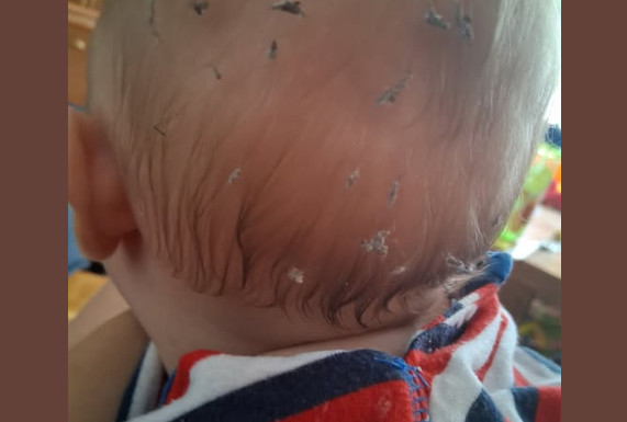 „Bebi se stalno prave čvorići u kosi“ Mama pitala kako da ih ukloni, roditelji otkrili uzrok