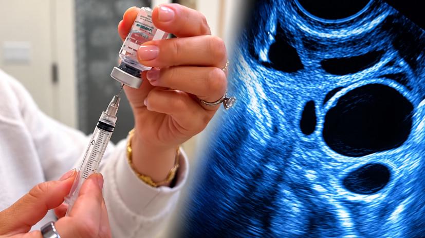 Koliko jajnih ćelija treba zamrznuti za jednu bebu? Doktorka otkrila brojke koje se drastično menjaju sa godinama