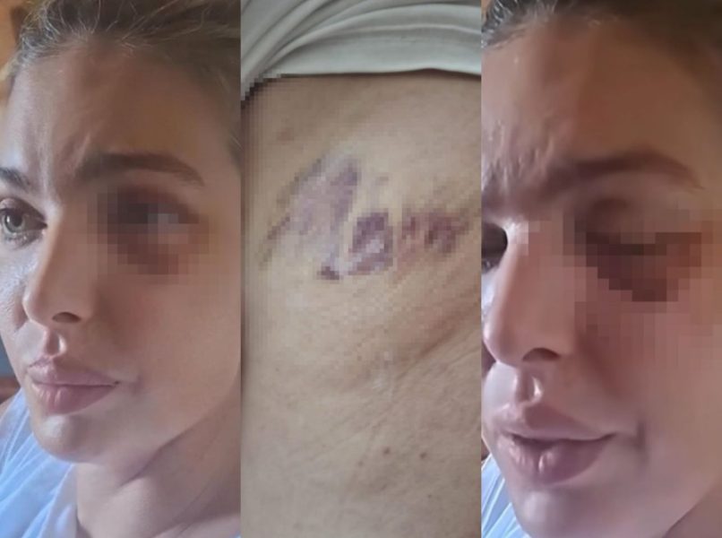 Ava Karabatić progovorila o paklu koji je preživela: Snimak na TikToku potresao region. Nijedna žena ne sme da trpi nasilje