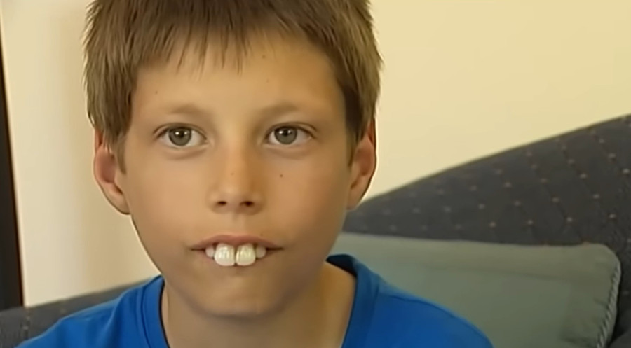 „Zvali su ga dečak zec i rugali mu se zbog zuba“: Pet godina kasnije Evan je pokazao osmeh koji je rasplakao mnoge