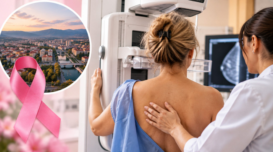 Žene od 45 do 69 godina mogu na besplatan pregled bez uputa i zakazivanja: Evo gde i kada se organizuje mamografija