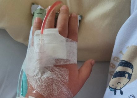 „Koža mu je otpadala zajedno sa majicom“: Kristinin sin zadobio teške opekotine zbog kuhinjskog uređaja koji svakodnevno koristimo